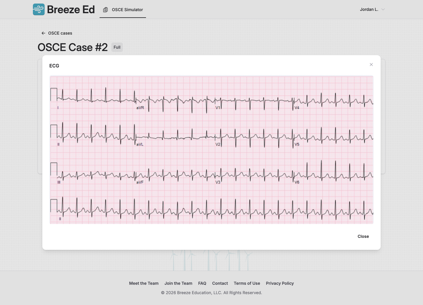 Real OSCE room showing the diagnostics document rail with an ECG open.